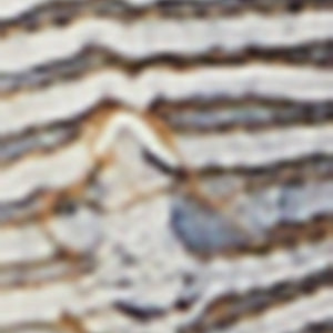 Mens Acid Wash Distressed Moto Skinny Jeans