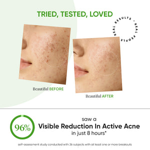 Acne Spot Correction Gel with 2% Salicylic + Cica