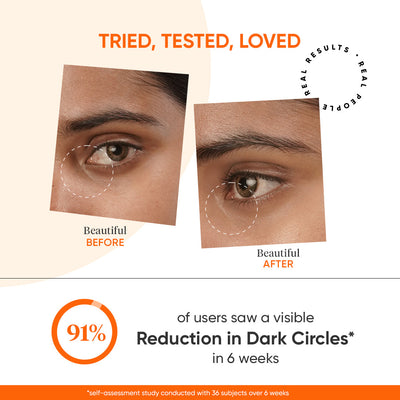 Vitamin C + E Eye Cream SPF 30 for Dark Circles