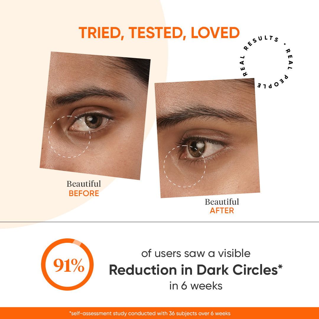 Vitamin C + E Eye Cream SPF 30 for Dark Circles