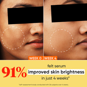 10% Vitamin C + E Face Serum with 5% Niacinamide