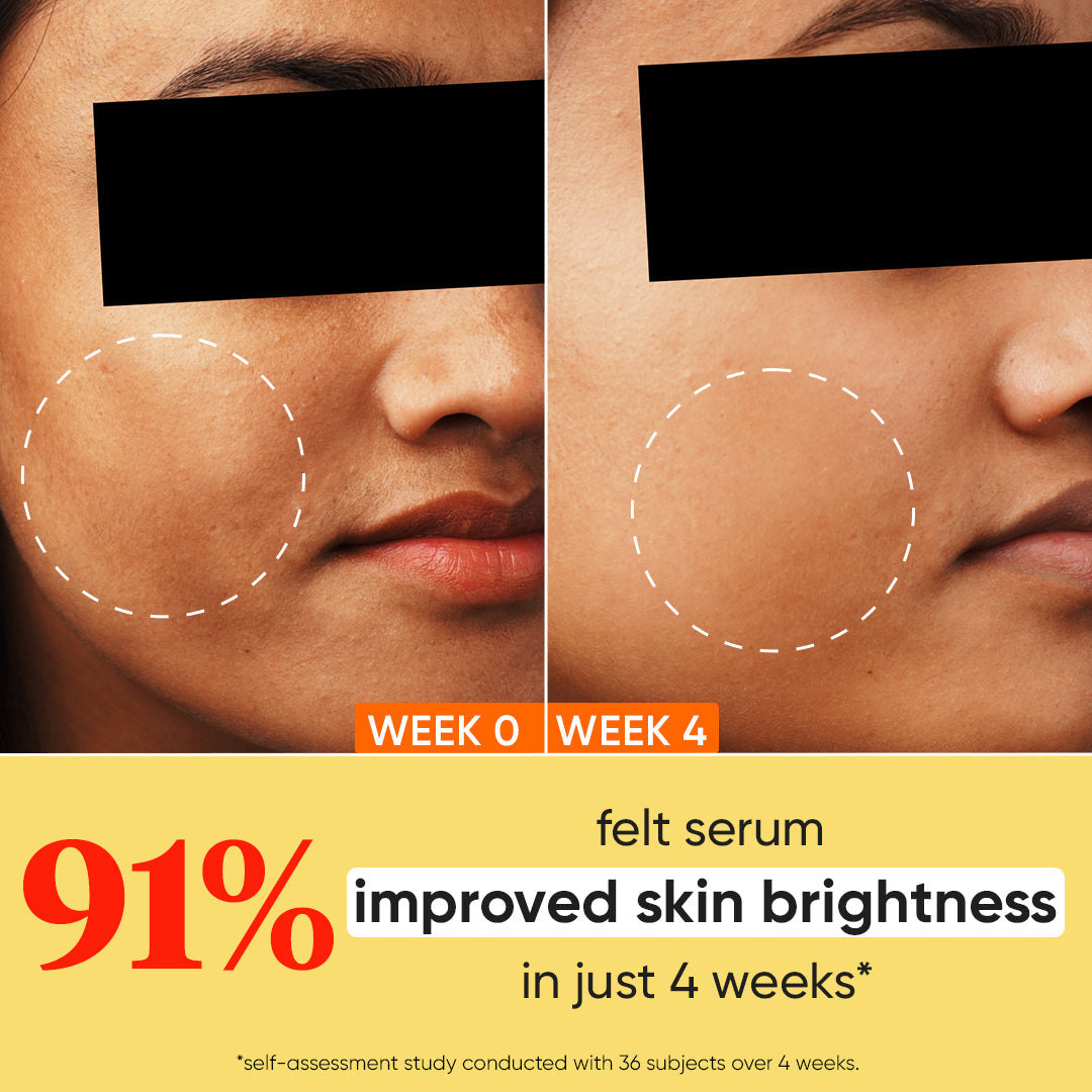 10% Vitamin C + E Face Serum with 5% Niacinamide
