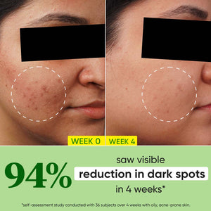 Cica + 10% Niacinamide Face Serum for Oily Skin