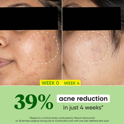 Cica & Niacinamide Night Gel for Oily & Acne Prone Skin