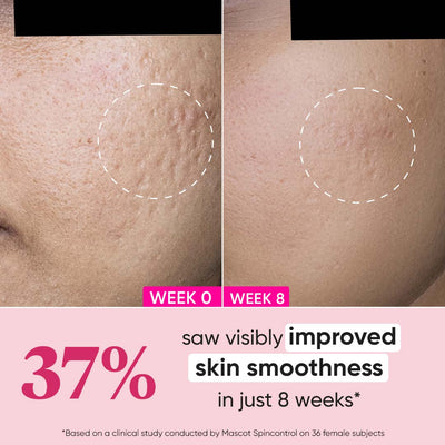 Retinol + Ceramide Night Cream for Fine Lines & Wrinkles