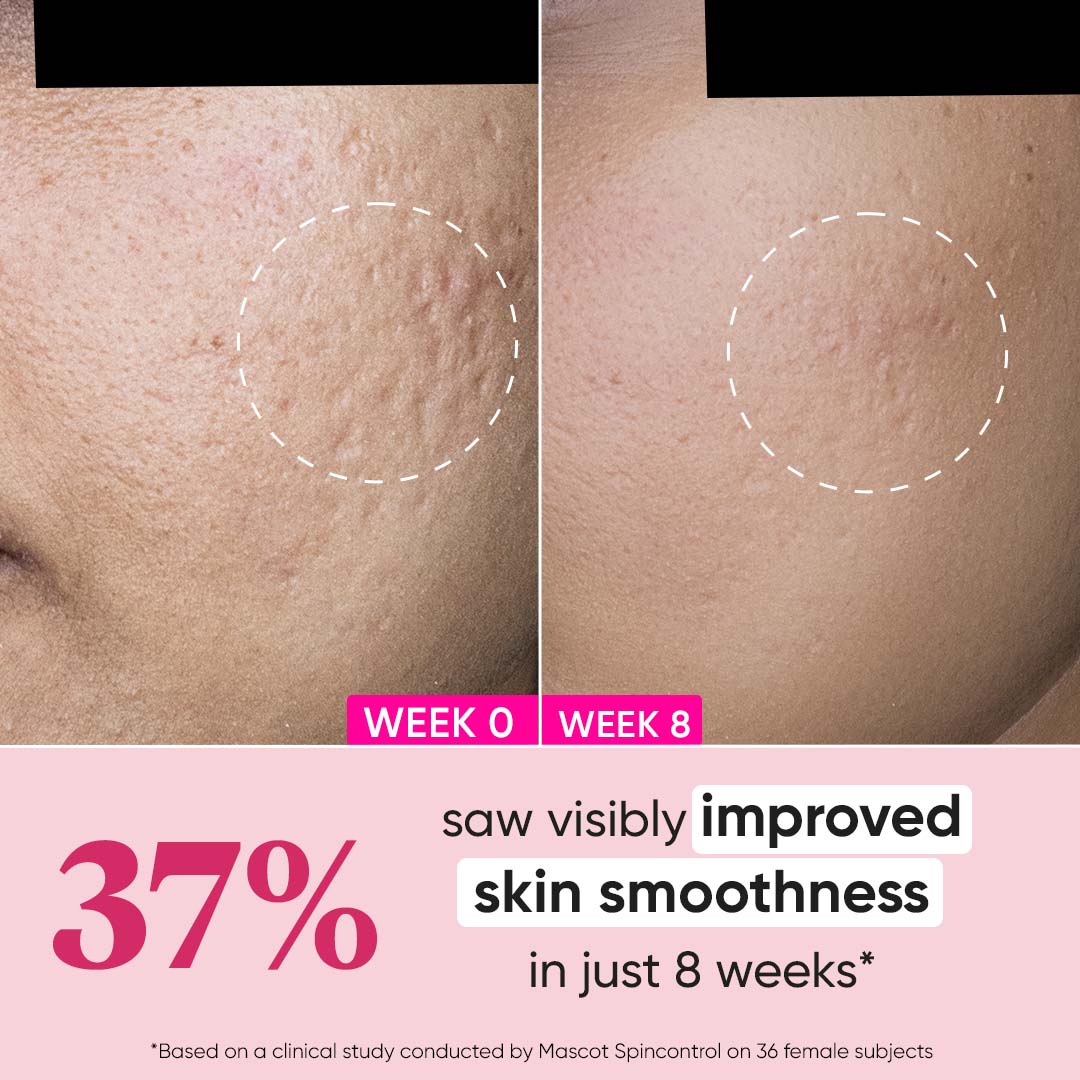 Retinol + Ceramide Night Cream for Fine Lines & Wrinkles