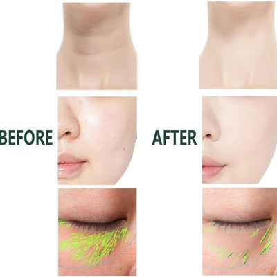 3 In 1 Anti Wrinkles Facial Massager For Skin Care